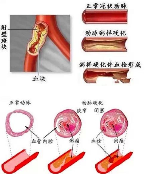 凈水器租賃